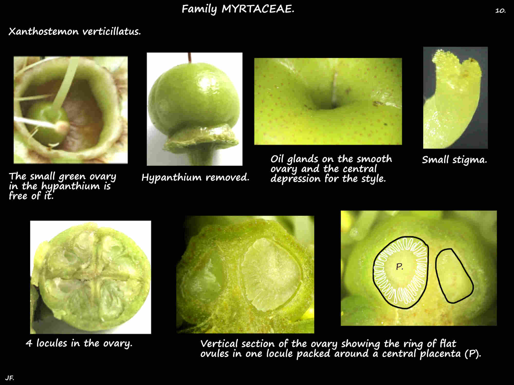10 Ovary & ovules of Xanthostemon verticillatus