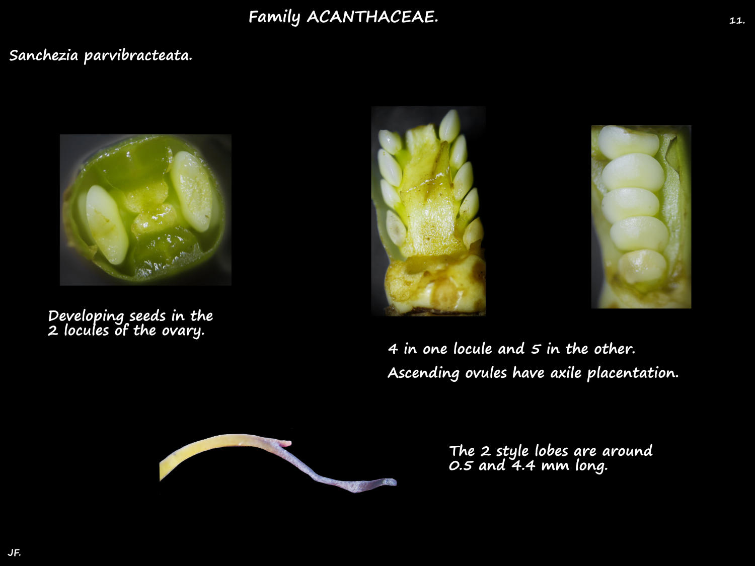 11 Sanchezia ovary & stigma lobes