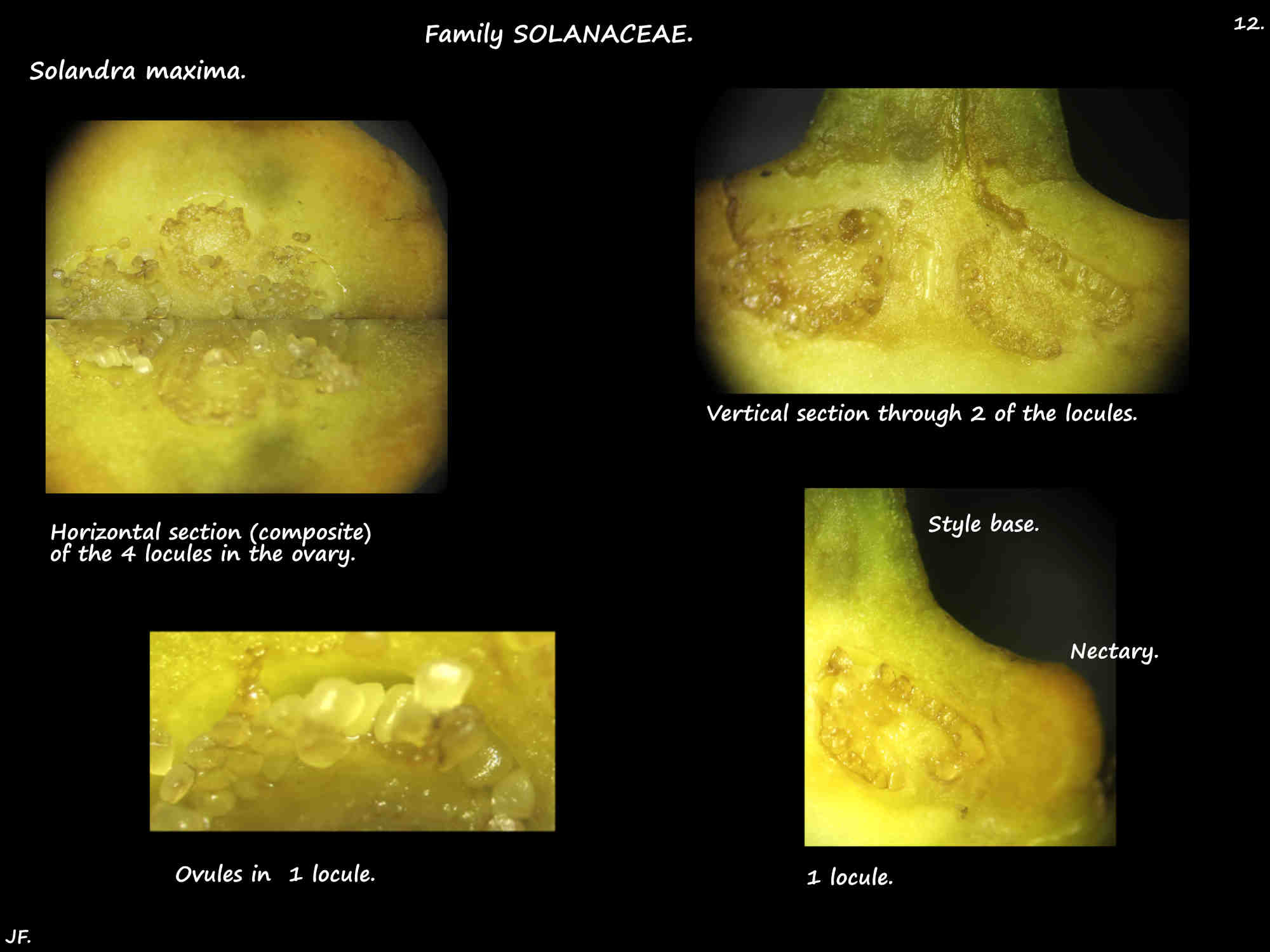 12 The 4 locules of a Solandra maxima ovary
