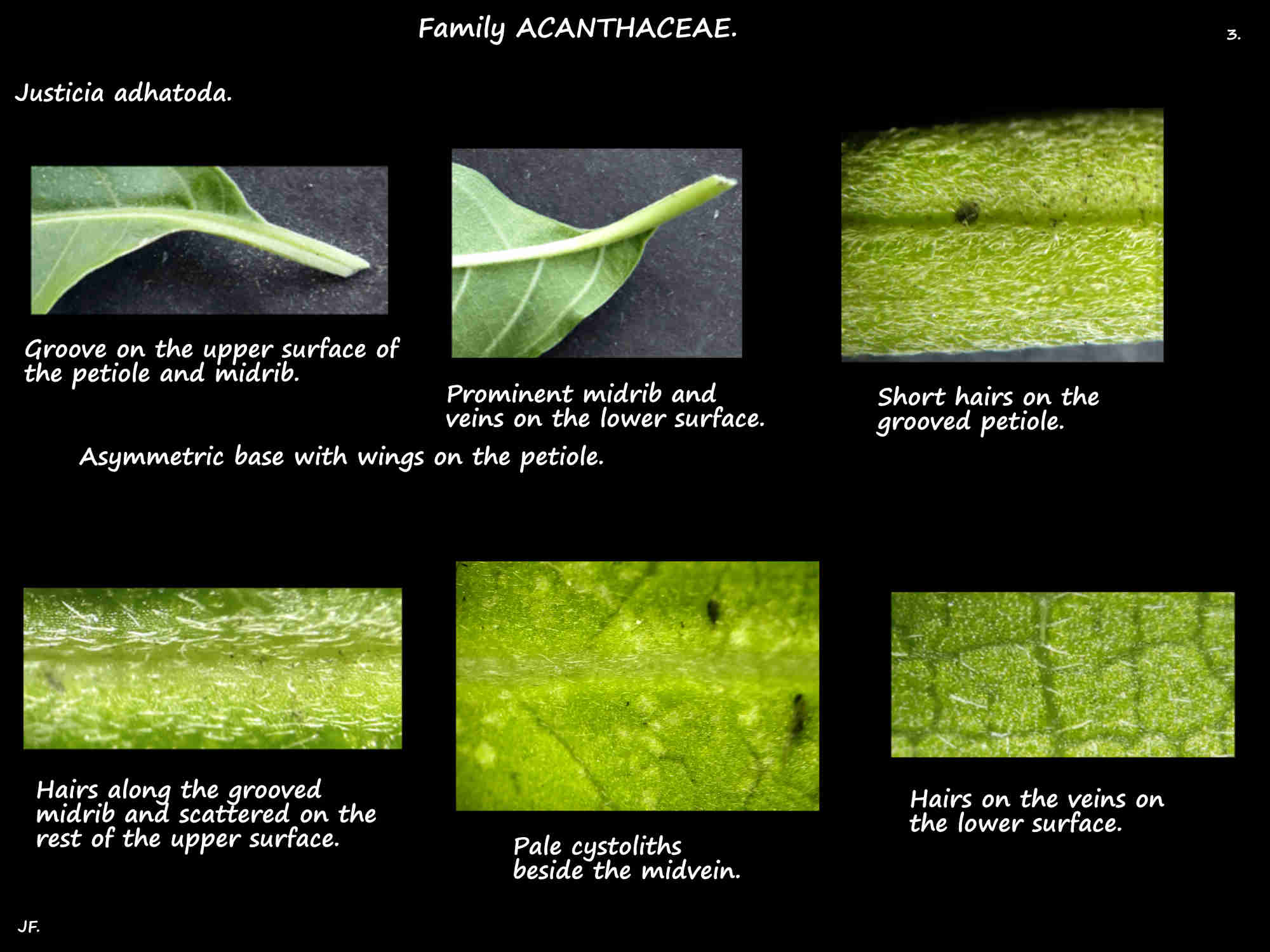 3 Cystoliths & hairs on Justicia adhatoda leaves