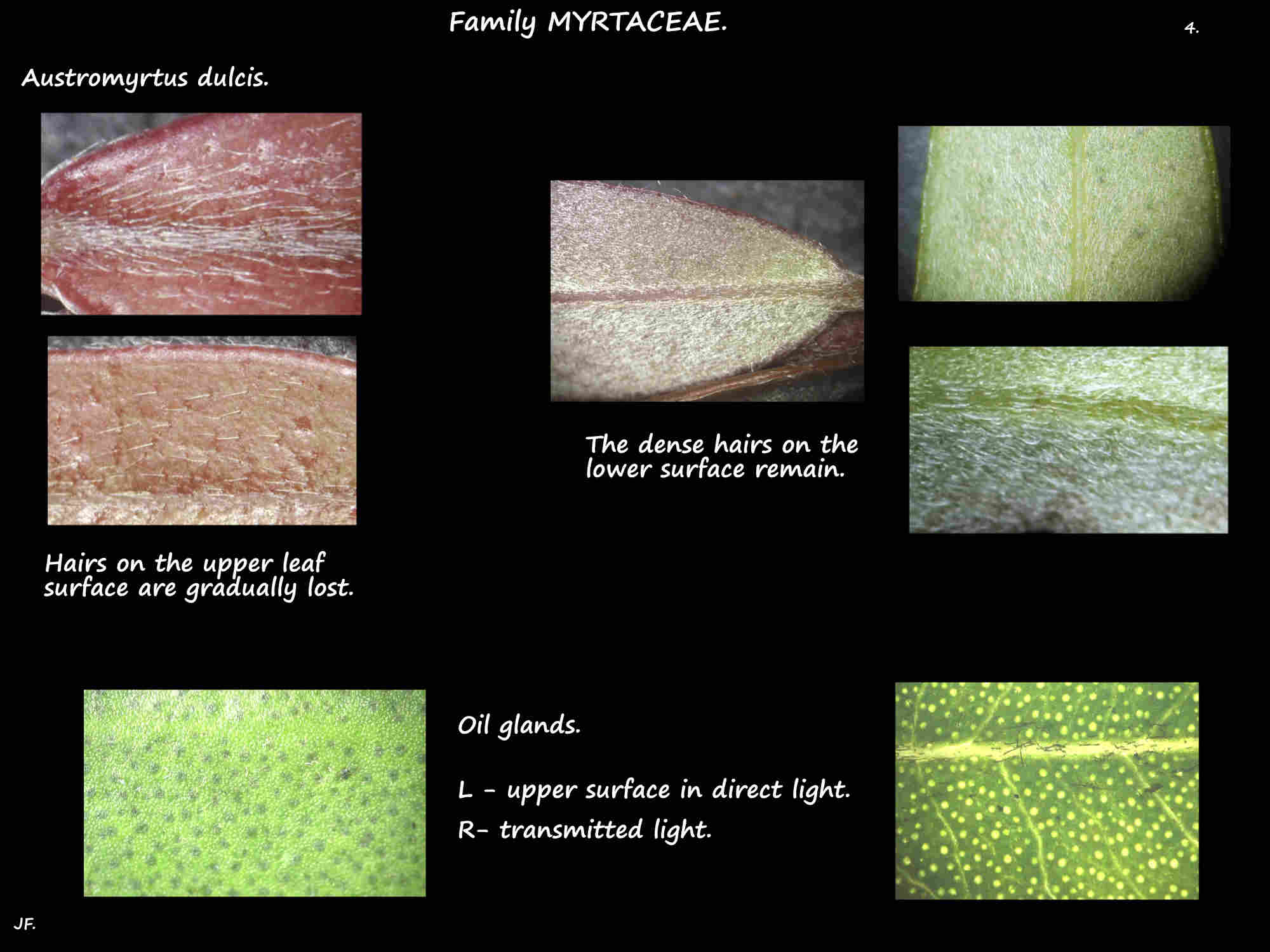 4 Austromyrtus dulcis leaf hairs & oil glands