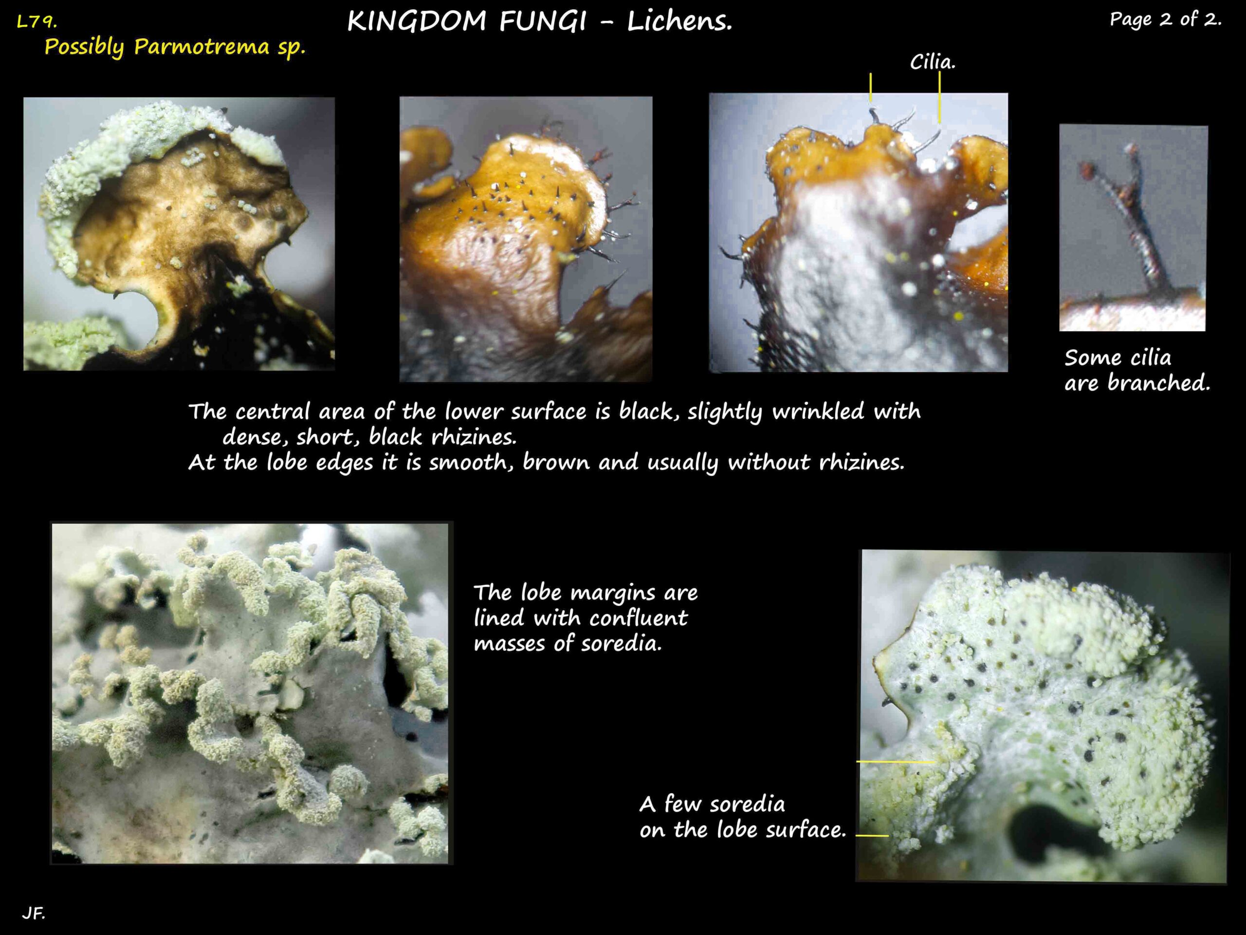 3b Cilia, rhizines & soredia of a possible Parmotrema lichen