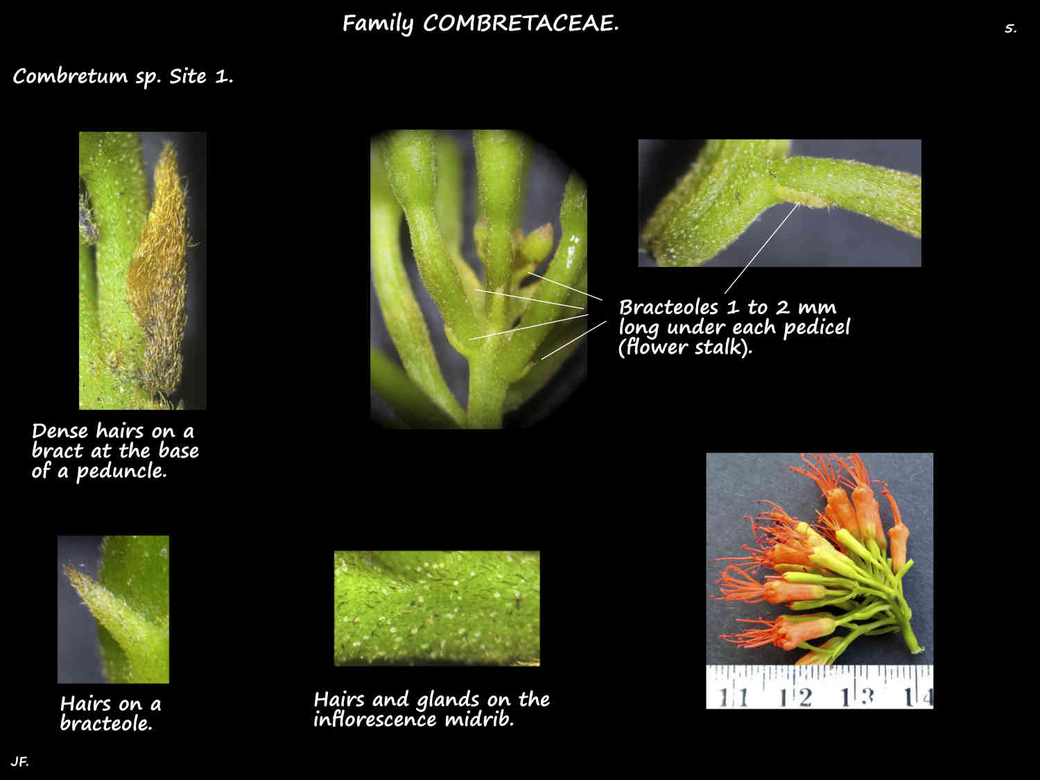 5 Hairs on Combretum bracts & bracteoles