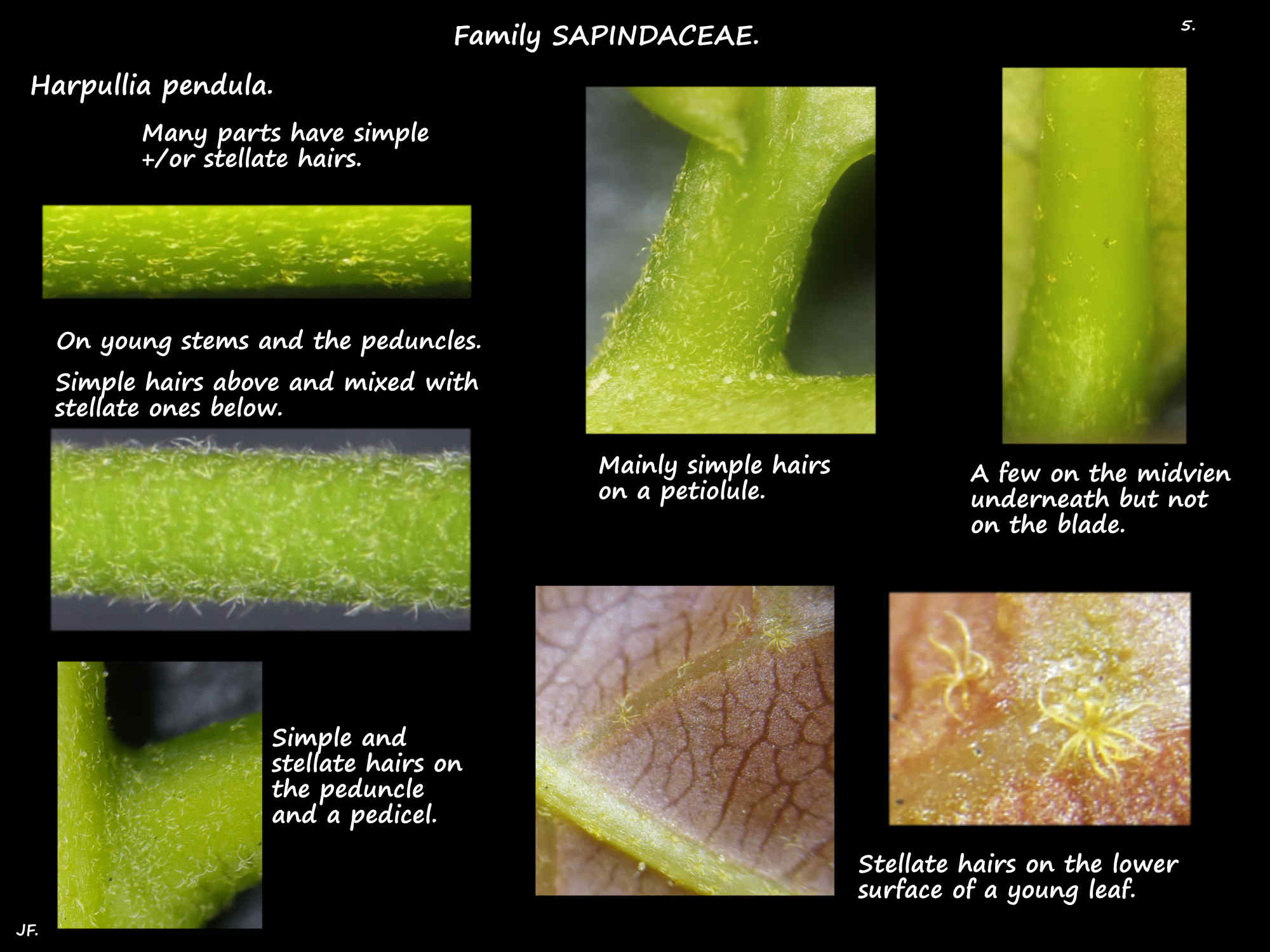 5 Simple & stellate hairs on Harpullia pendula leaves