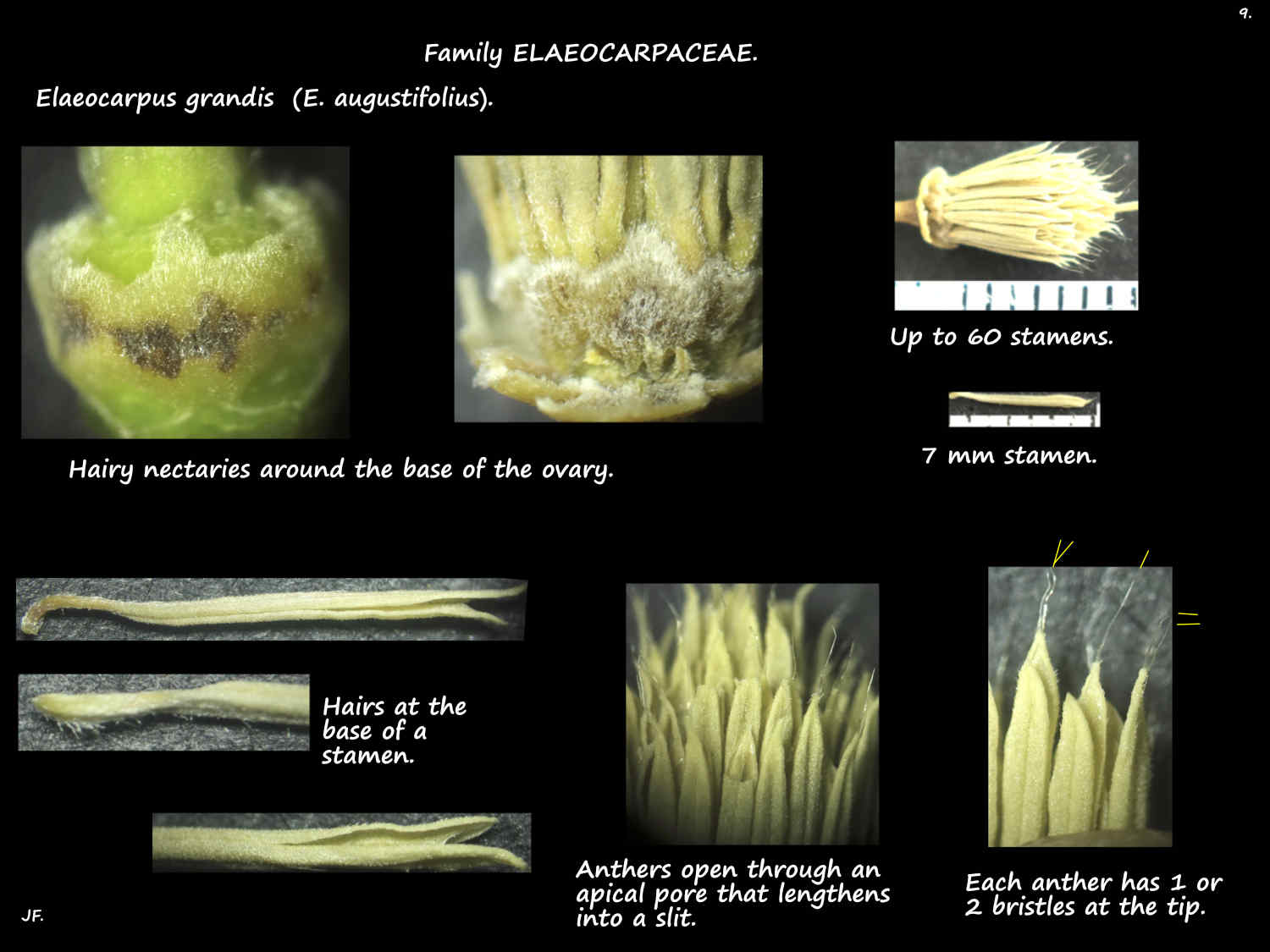 9 Hairs on Elaeocarpus grandis nectaries & stamens