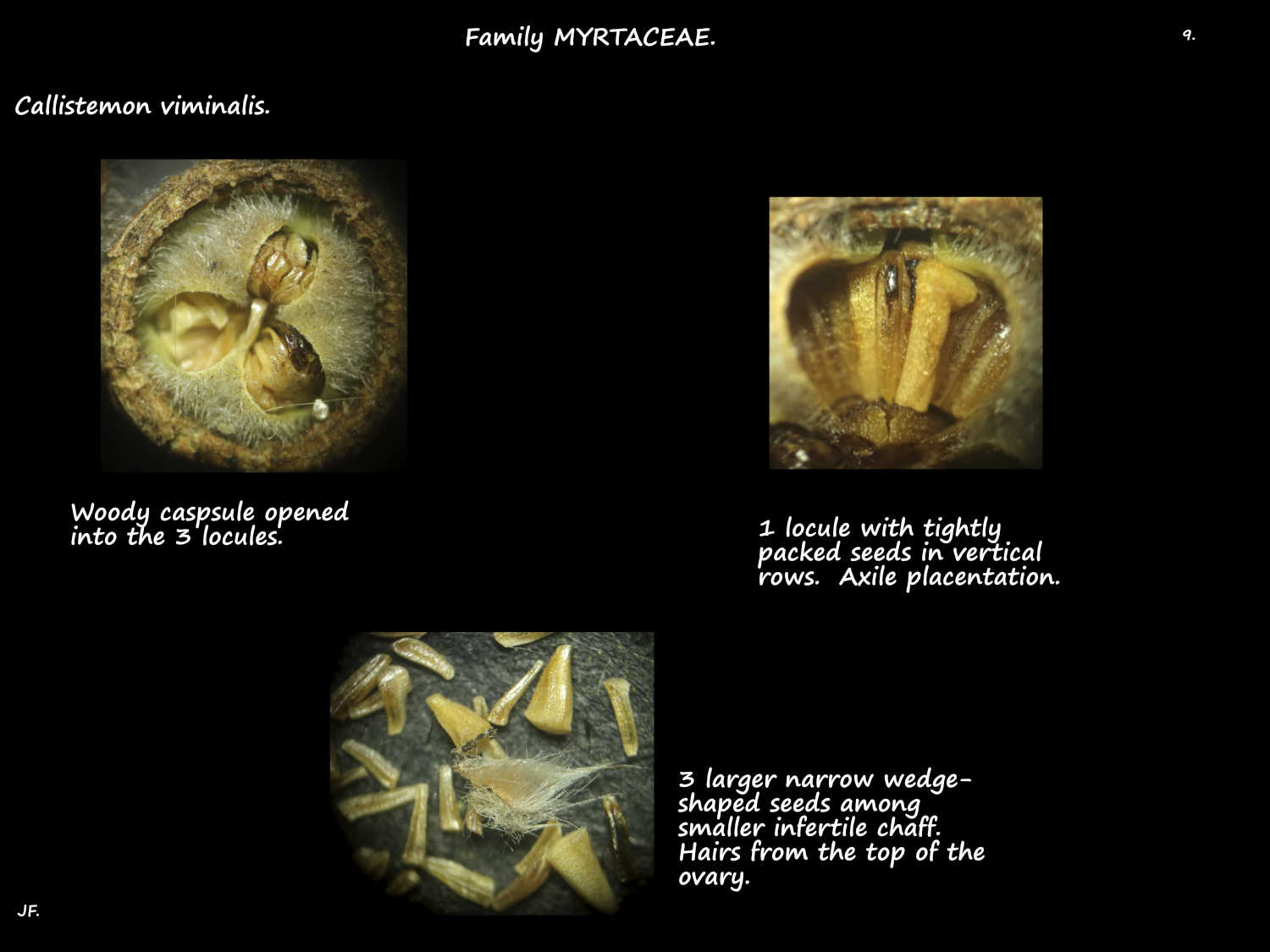 9 Weeping Callistemon capsules and seeds